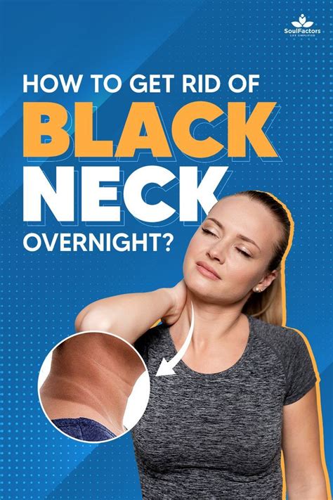 how to get rid of black neck overnight