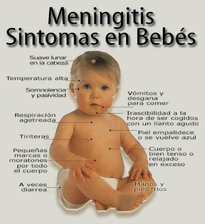 Dislocaci N Perder Disfraz Se Ales De Meningitis En Bebes Patr N