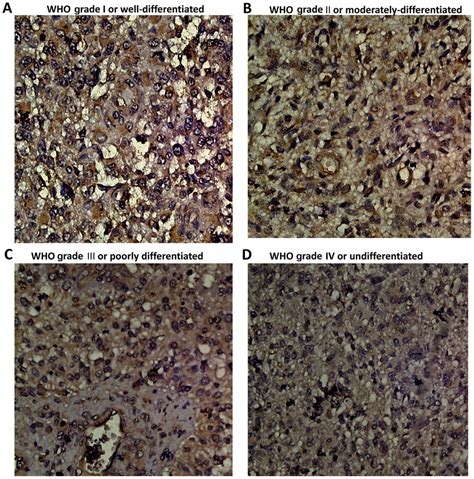 Immunohistochemical Staining Of Tumor Suppressor Candidate 3 Expression