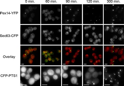 Pex14p trafficking during peroxisome biogenesis in pex3 cells ... 