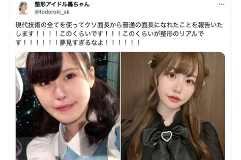 【画像・写真】整形アイドル轟ちゃん「これが整形のリアル」費用1300万円・10回以上も手術した人気ユーチューバーの訴えに反響、「始めたら一生終わらない」ネット上で共感と感謝の声 週刊女性prime