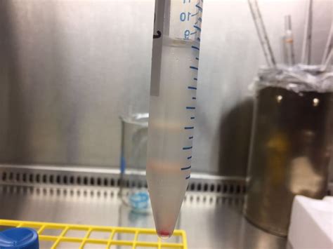 Can anyone offer help for neutrophil isolation through Percoll ...