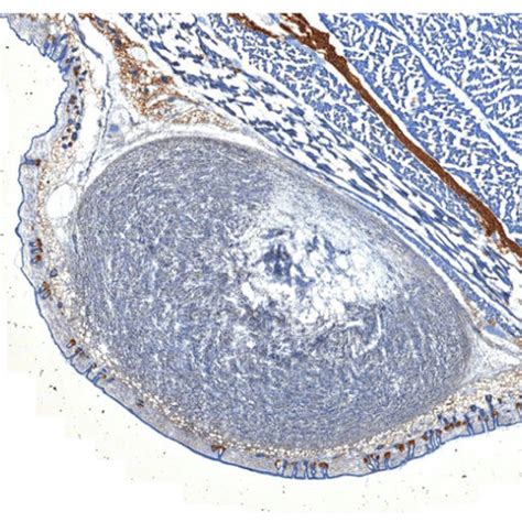 representative histological slice   tumor mass