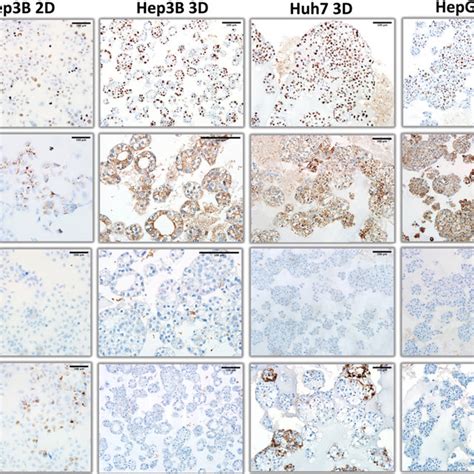 Comparative Immunohistochemical Analysis Of Ki 67 CK18 CK7 And