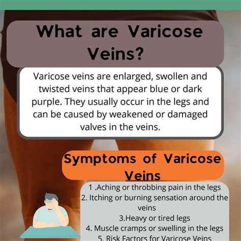 Varicose Veins Causes Symptoms And Treatment Options