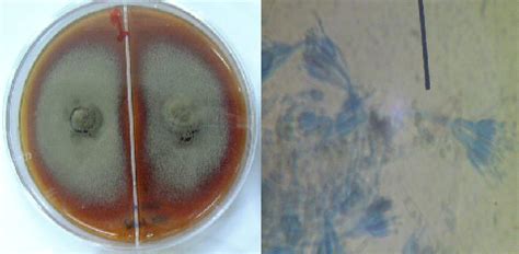 lengkung langit koloni belanda koloni bakteri  beri beri