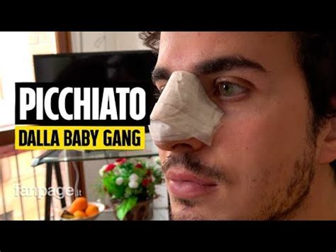 Parla Il Prof Picchiato A Scuola Da Una Baby Gang Fa Tristezza Ma