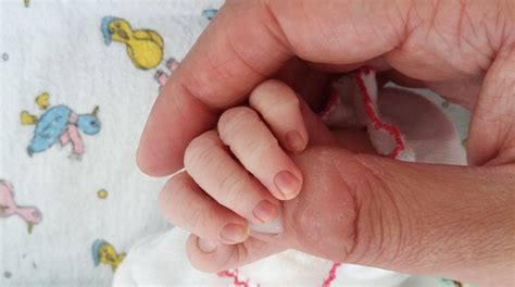 Part 1 of My Battle with Postpartum Thyroiditis: Three months following