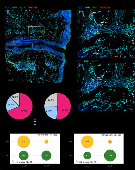 Mast cells are the main cells staining IL-17 + in the early stages of ...