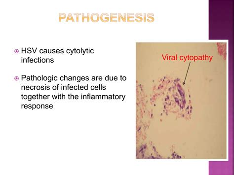 Herpes Simplex Virus Ppt