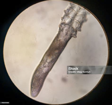 Demodex Folliculorum Parasitic Mite On The Eyelashes Of A Human Eye