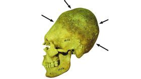 Cemetery Full Of Deformed Long Skulls Reveals The Chaos After The Fall ...