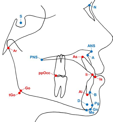 Cephalometric landmarks used in the present study. A total of 10... | Download Scientific Diagram