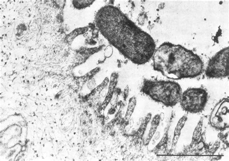 Transmission Electron Micrograph Of A Thin Section Of A Ruthenium