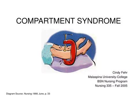 Ppt Compartment Syndrome Powerpoint Presentation Free Download Id