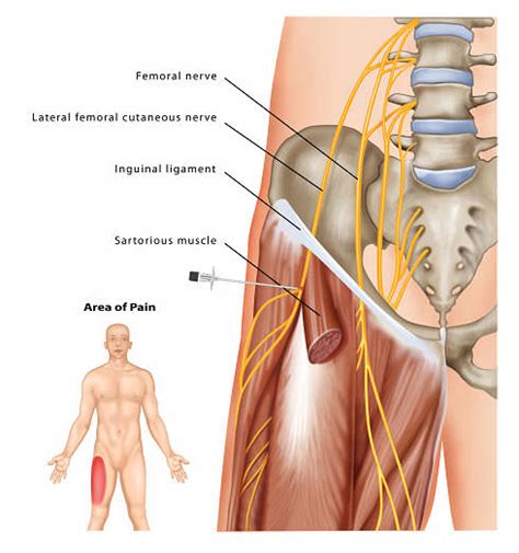 Femoral Nerve
