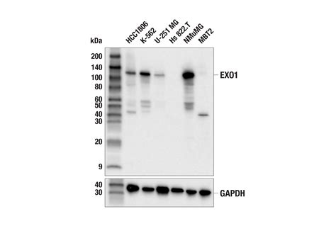 EXO1 (E6P2B) Rabbit mAb | Cell Signaling Technology