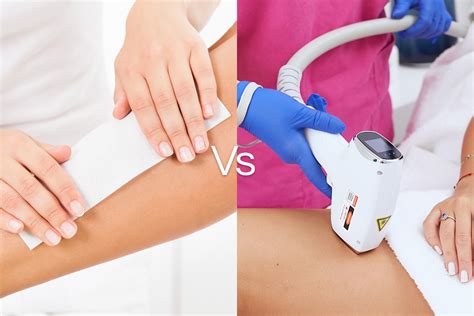 Laser Hair Removal Vs Waxing Which Is Better For Long Lasting Results