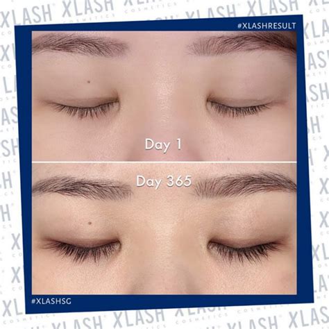Xlash Cosmetics Singapore | Xlash eyelash serum