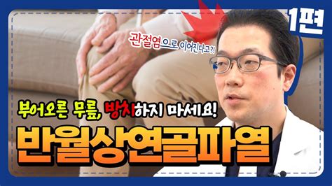 무릎통증을 유발하는 반월상 연골 파열 방치하면 관절염에 치료 불가😱 원인과 증상 같이 알아봐요~ 나이스병원tv