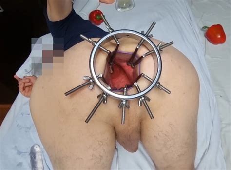 Mega Anal Spreader Nude Pics Xhamster