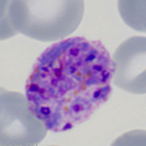 biology   schizont malariaetc