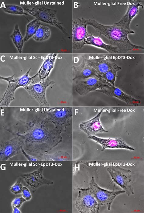 Uptake of aptamer Dox conjugate on Müller glial cells addition in