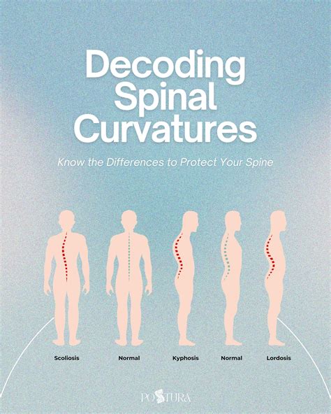 Cebu Center for Scoliosis and Osteopathy