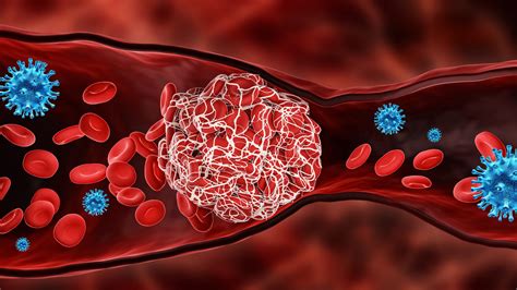 Tag: Inflammation in blood vessels - CUHK in Touch