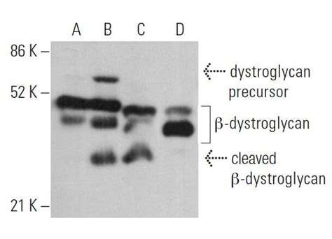 Anti β Dystroglycan Antibody 7d11 Scbt Santa Cruz Biotechnology