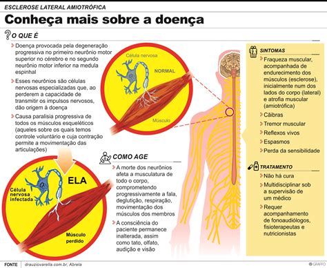 Estagio Final Da Doença Ela - Doença Ela Causas _ Esclerose Lateral Amiotrófica (ELA) – LJPRRC