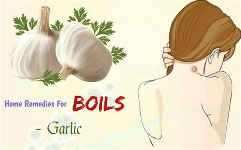 Home remedies for boils and cysts on face, back or leg