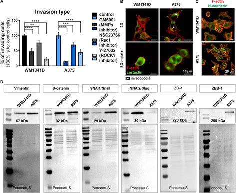 Frontiers Thymosin β4 Regulates Focal Adhesion Formation in Human