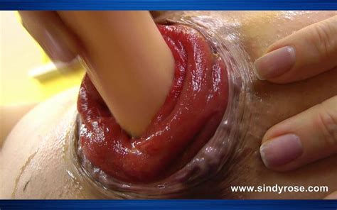 Sindy Rose Pumpt Ihren Analprolaps Mit Penispumpe Fickt Es Mit Dildo XHamster