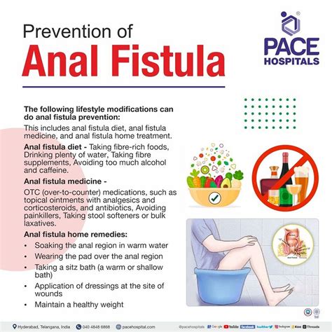 Anal Fistula Symptoms Causes Types Complications Prevention