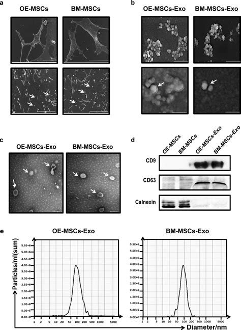 Isolation And Identification Of Exosomes Secreted By Oe Mscs And