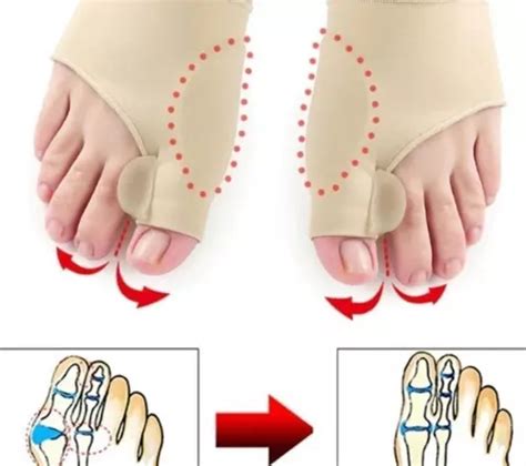 Par Meias Joanete Protetor Corretivo C Separador Dedos Cor Nude Mercadolivre