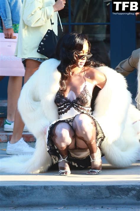 Winnie Harlow Reveals It All For Hot Lingerie Shoot In WeHo 20 Photos TheFappening