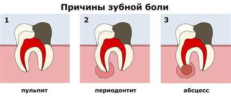 Зубная боль — виды, причины и лечение зубной боли | Клиника Семейный доктор