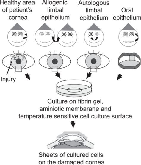 Corneal Regeneration By Using Cell Sheets Made Of Cultu Open I