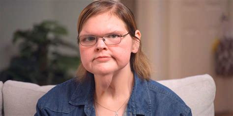 1000-Lb Sisters: 5 Ways Tammy Slatons Skin Removal Surgery Could End