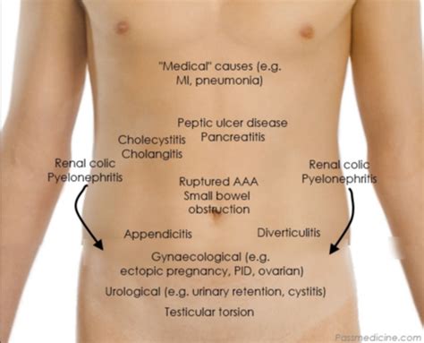 Abdominal Pain Flashcards Quizlet