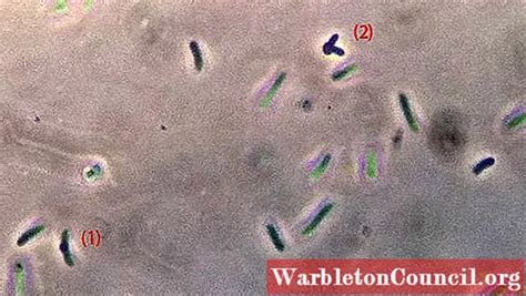 Proteus Mirabilis Characteristics Morphology Contagion Symptoms