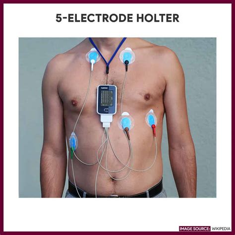 holter monitoring nursing responsibilities  care plan nurseslabs