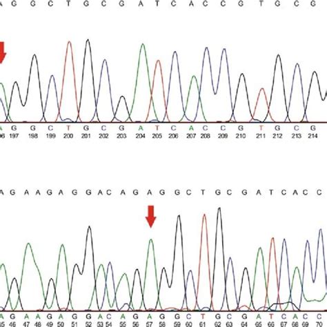 A Sequence Analysis Of Pcr Amplified Ret Gene Exon 11 Of The Proband