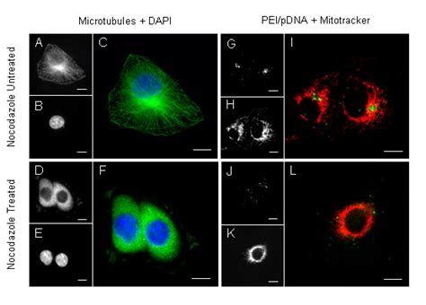 Effect Of Microtubule Disrupting Agent Nocodazole On Microtubule