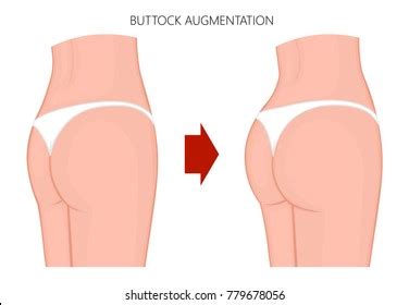 Hundred Before After Naked Woman Royalty Free Images Stock Photos Pictures Shutterstock