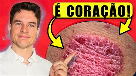 É Normal Ver O Coração Pulsar Na Pele - 12 Sinais na Pele que Revelam Problemas no Coração - YouTube