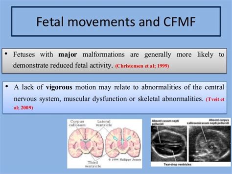 Decreased fetal movements 