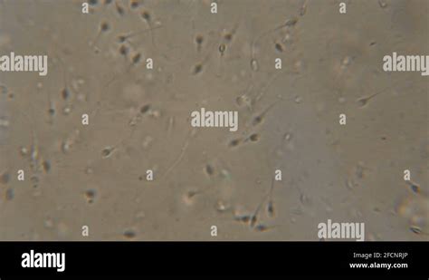 Sperm Spermatozoa Viewed Under The Microscope Moving Human Sperm